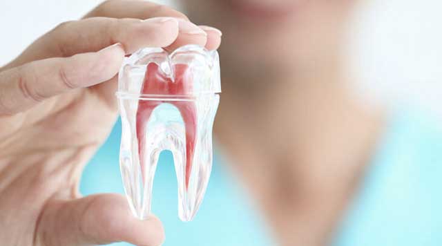 Ai-je besoin d’un traitement endodontique si je n’ai pas de douleur dentaire ?